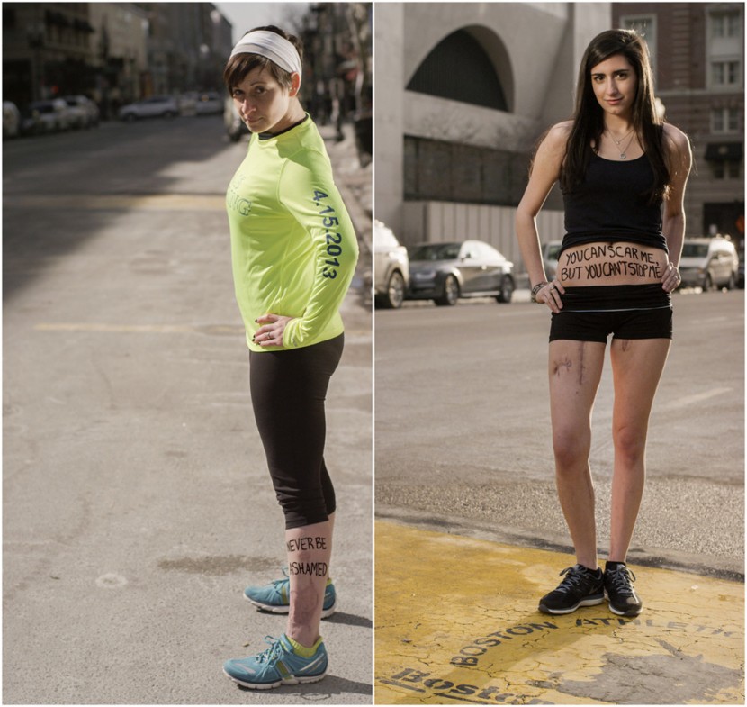 Portraits Of Boston Marathon Survivors 7